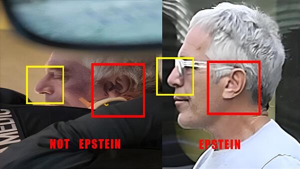 Epstein body (1) (1)