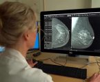 Le tre grandi bugie sullo screening mammografico che tutte le donne devono  assolutamente conoscere