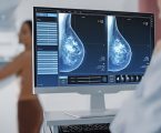 E se non si fosse mai trattato di cancro? Ecco le prove che smontano le argomentazioni a favore dell’intervento chirurgico al seno